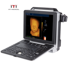 Clear Imaging Digital 3D/4D Portable Color Doppler Cardiac Echocardiographie Ultrasound Machine